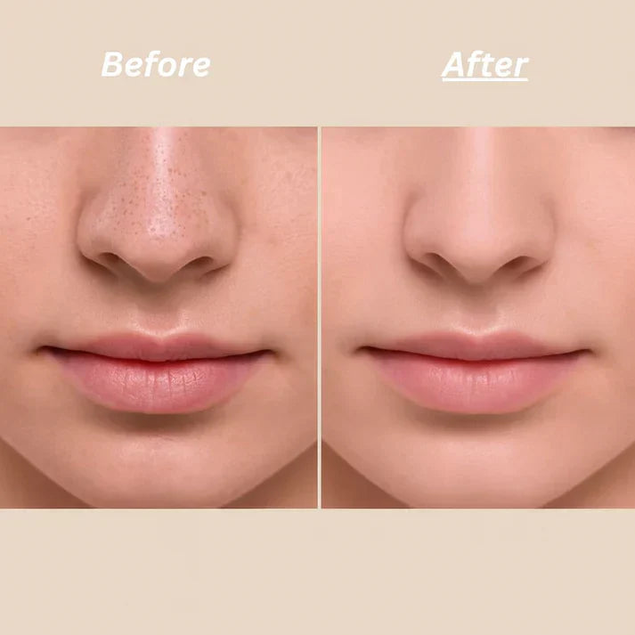 Dr Melaxin Peel Shot Ampoule