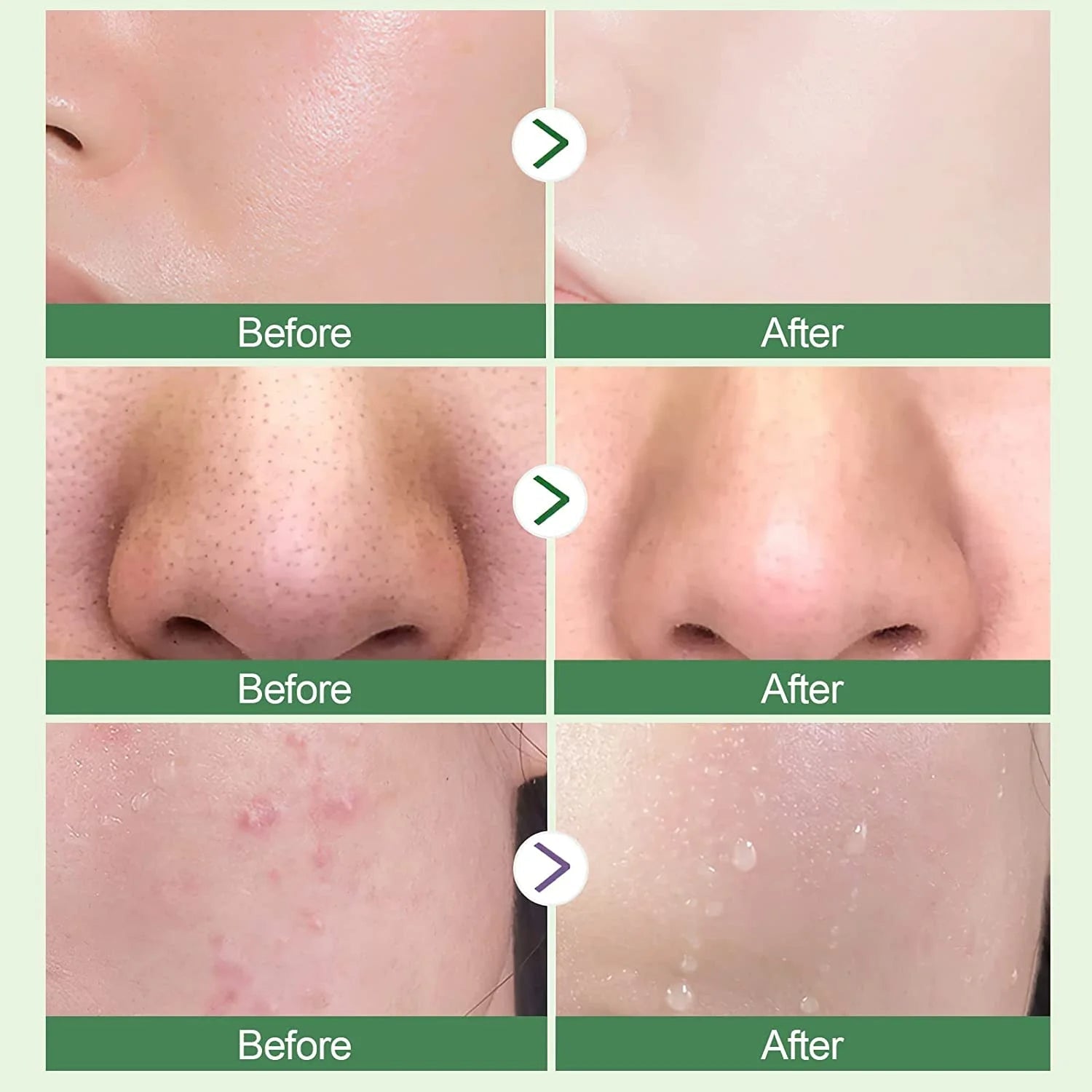 Green Tea Mask Stick Blackhead Remover
